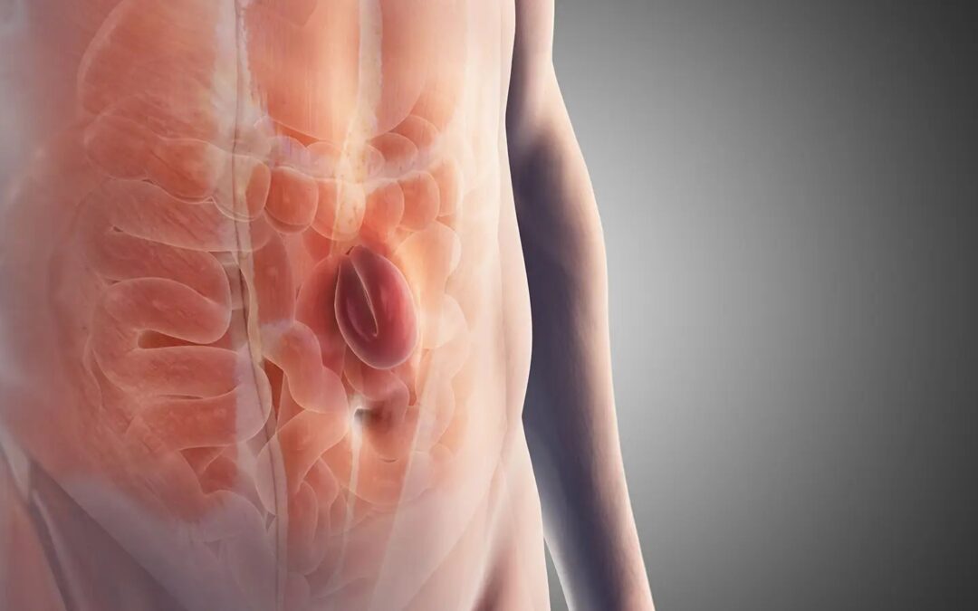 Hernia Repair